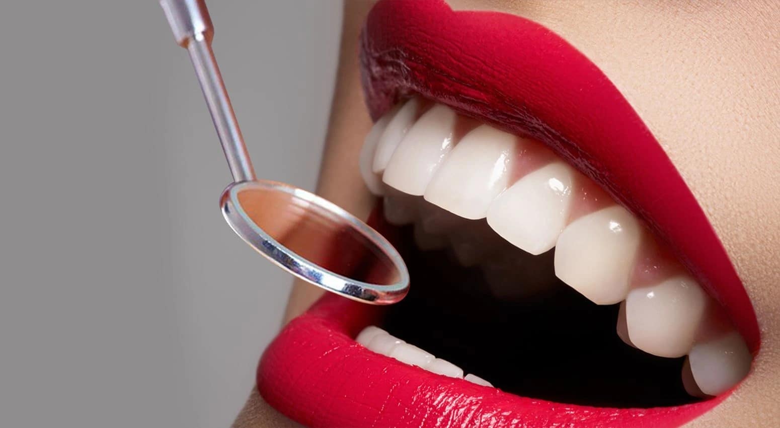 Ceramic veneers – maximum aesthetics, minimal intervention